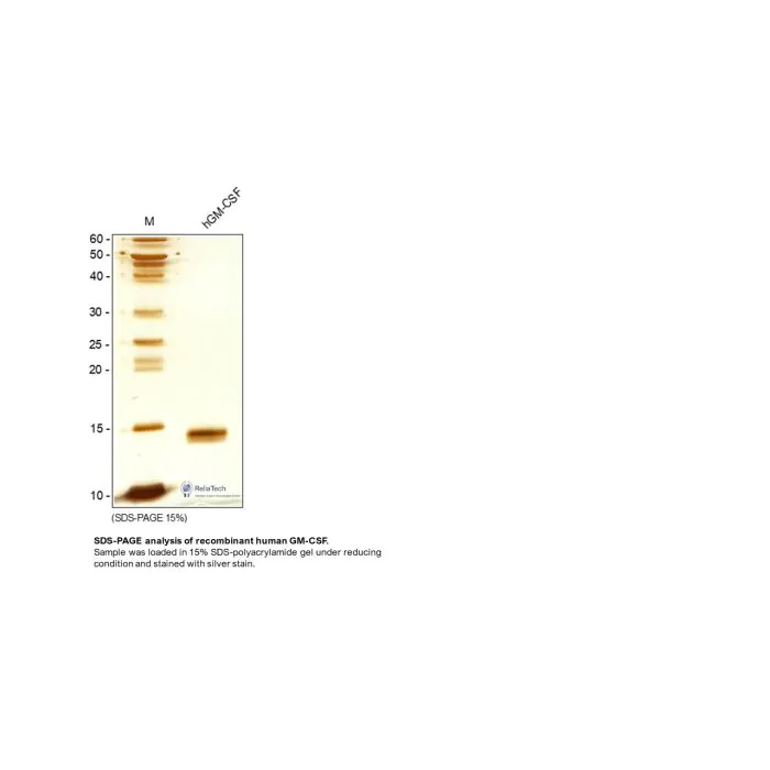 human GM-CSF protein (His-Tag) human GM-CSF protein (His-Tag)